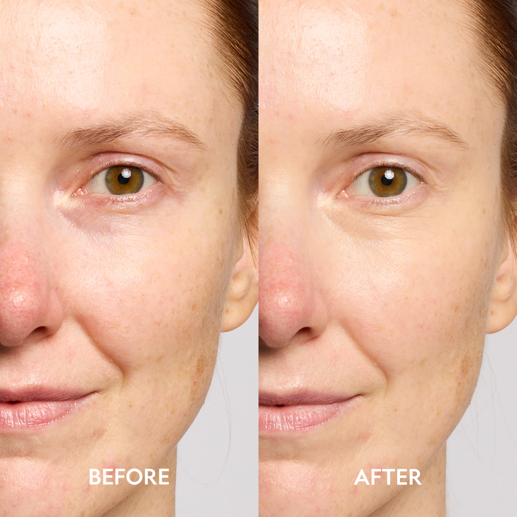 Dark Circle Serum Peptide Corrector