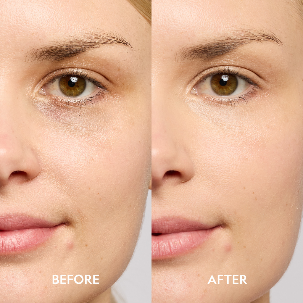 Dark Circle Serum Peptide Corrector